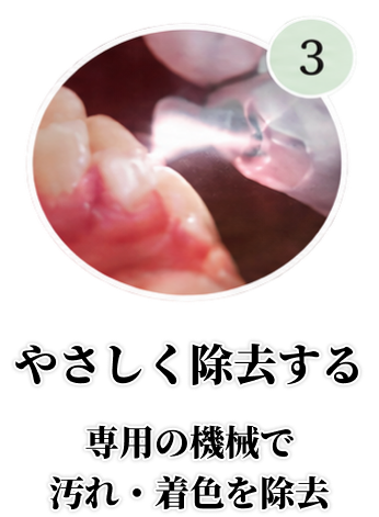 やさしく除去する