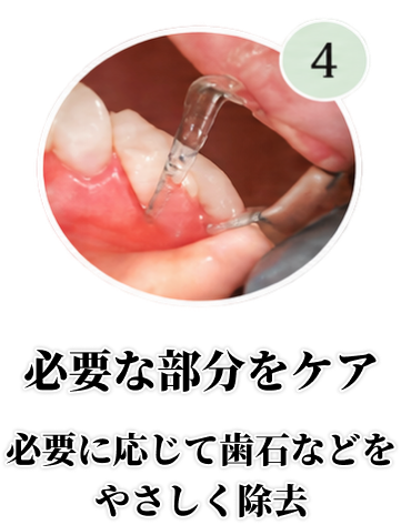 必要な部分をケア